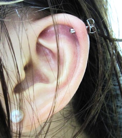 Lump In Ear Cartilage Pictures Photos