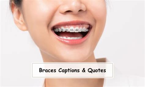 Braces Captions And Quotes For Instagram