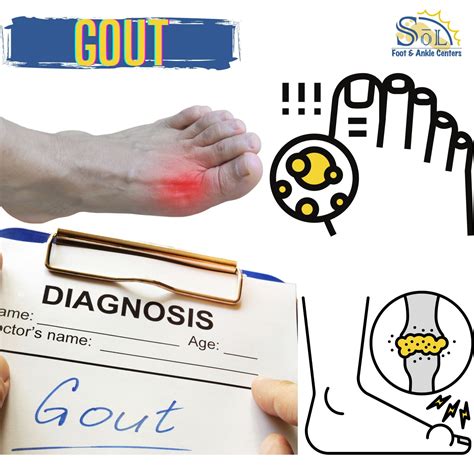 All About Gout Sol Foot And Ankle Centers