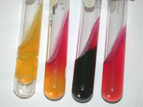 Medical Blogs Principle Of Biochemcial Test Of Gram Negative Bacteria
