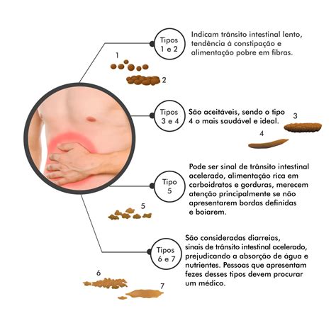 O que os tipos de fezes podem dizer sobre sua saúde Clínica Gástrica Usuy