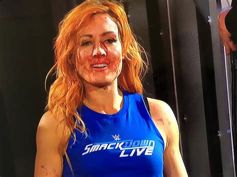 Bill Collmer On Twitter Bad Ass Becky Lynch Is The Man