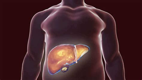 Is Your Liver Inflamed Step To Health