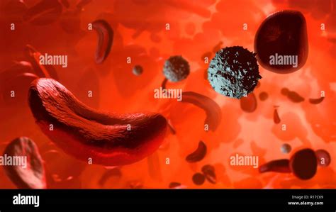 Sickle Cell Anaemia Artwork Showing Hi Res Stock Photography And Images