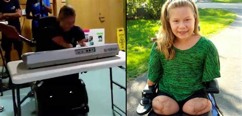 This Girl Lost All Four Limbs Due To A Deadly Bacterial Disease But That Didn’t Classic Fm
