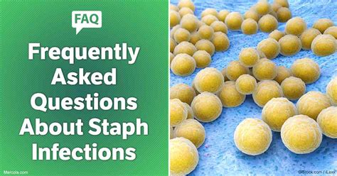 Frequently Asked Questions About Staph Infections