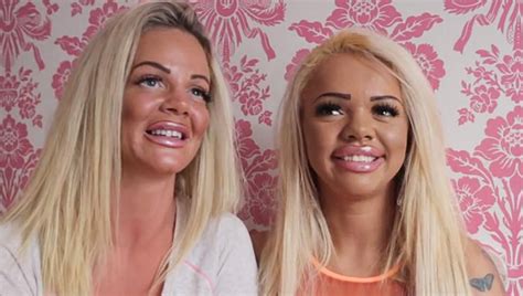 Mother And Daughter Used Sugar Daddy To Spend 86000 On Matching Plastic Surgery