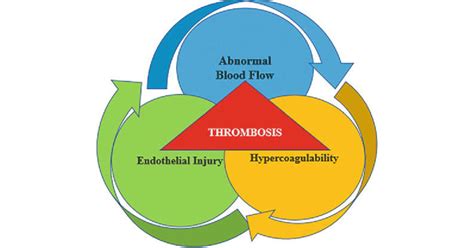 Mechanisms Of Virchow Triad In The Pathophysiology Of Thrombus