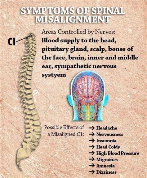 Symptoms Of Spinal Misalignment Chiropractic Chiropractic Therapy