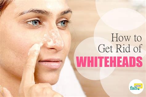 How To Get Rid Of Whiteheads On Nose And Face Oily Nose White Heads
