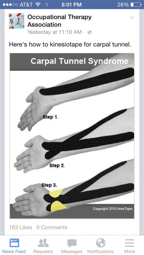 Tape For Carpal Tunnel Kinesiology Taping Carpal Tunnel Carpal