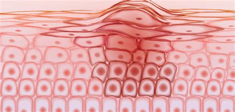 Molecular Research Builds New Understanding Of Skin Regeneration News