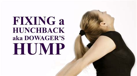 Fixing A Hunchback Aka Dowagers Hump How To Get Rid Of A Neck Hump Youtube