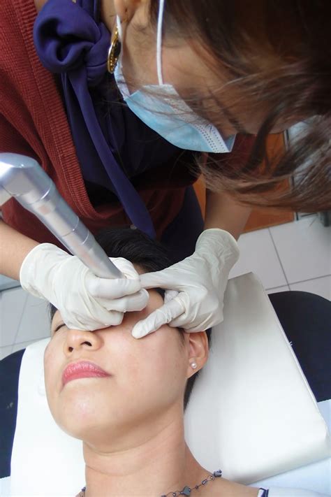 Follow Me To Eat La Malaysian Food Blog Co2 Laser For Removal Of