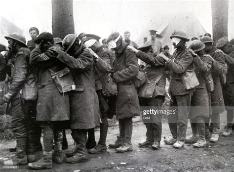 World War I 1914 1918 British 55th Division Troops Blinded By Tear