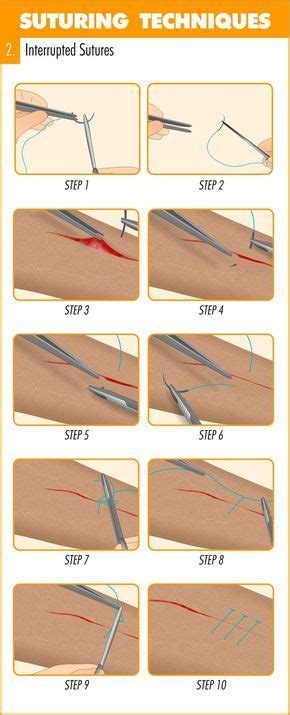 Complete Guide To Mastering Suturing Techniques Suture Techniques Surgical Suture Suture Kit