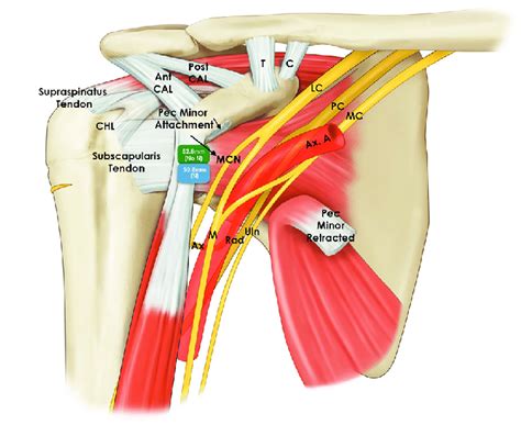 This diagram depicts shoulder muscles anatomy diagram. Conjoined Tendon Shoulder Anatomy : Rotator Cuff Anatomy General Practice Notebook : The ...