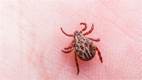 Cdc Confirms Case Of Rare Tick Borne Powassan Virus In Maine