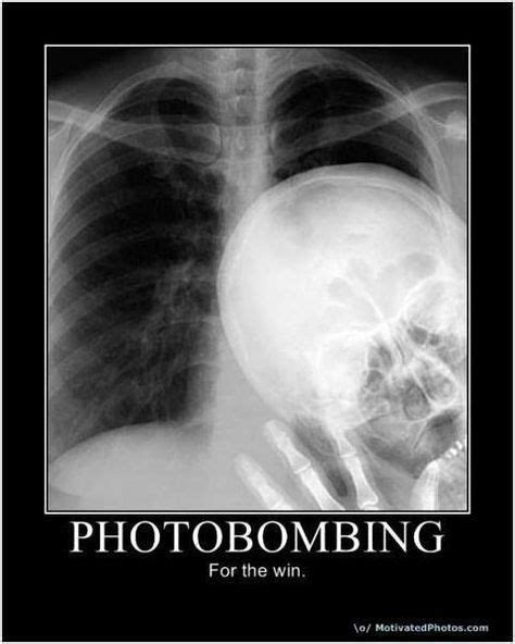 10 X Ray Humor Ideas X Ray Xray Humor Humor