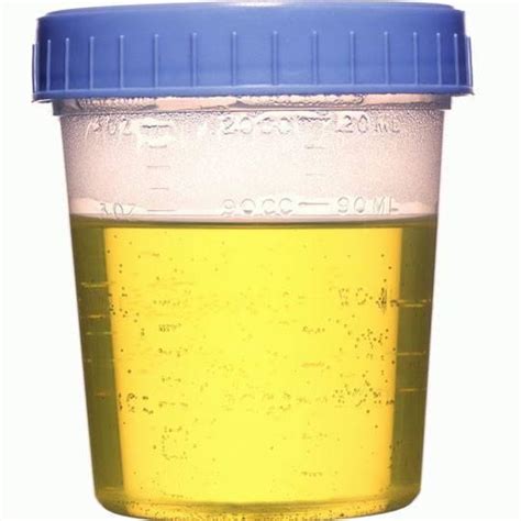Urine Specimen Collection Cup Sterile