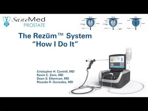 Rezum How I Do It Video BPH EDUCATIONAL VIDEO Dr Zorn YouTube