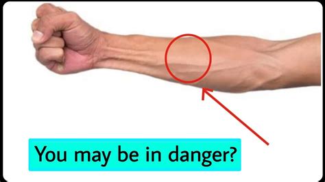 Why Veins Bulge Swelling Veins Know The Fact Youtube
