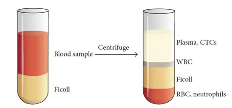 Schematic Representation Of Plasma Separation Of A Blood Sample By