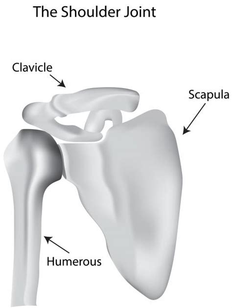 What Causes A Clavicle Bone Lump With Pictures