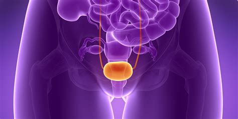 A need to urinate on a more frequent basis. Bladder Cancer Symptoms In Women - Bladder Cancer Causes