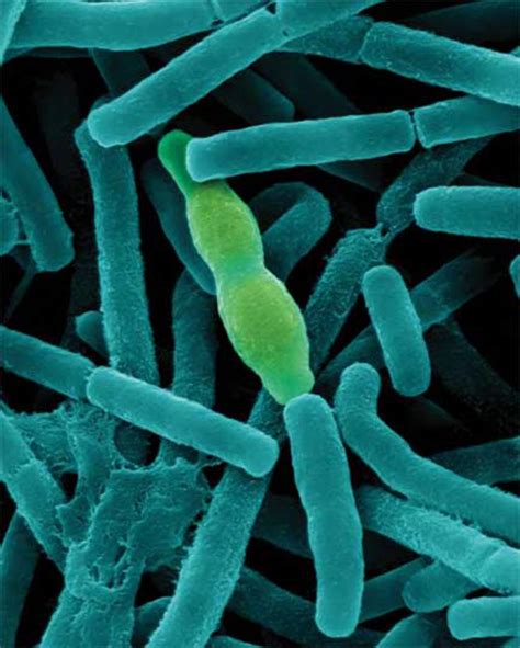 Bacillus Cereus Sucrose Fermenter Morphology Of Bacillus Subtilis