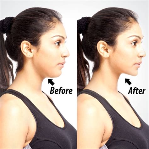 7 Techniques To Get Rid Of Double Chin Indian Beauty Tips