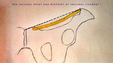 Mid Inguinal Point And Midpoint Of Inguinal Ligament Med Tutorials