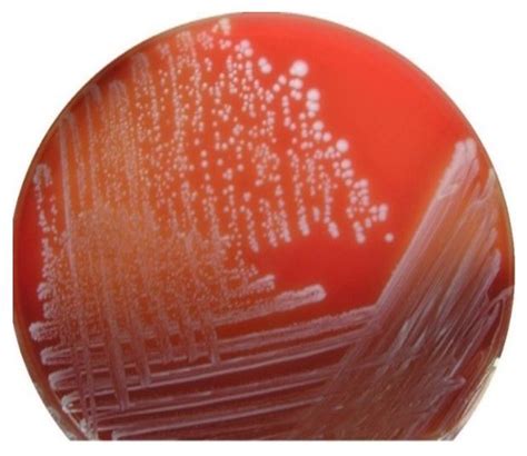 Pseudomonas Aeruginosa Emb Agar