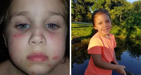 Bus Ride Was Complete Terror And Torture 5 Year Old Girl Attacked By 12 Year Old Bully On