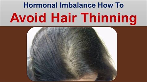 Hormonal Imbalance How To Avoid Hair Thinning Because Youtube