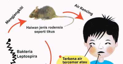 Kencing Tikus Leptospirosis Punca Tanda Rawatan Dan Pencegahan