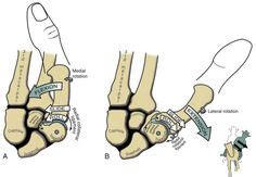 ideas de Anato funcional ortopedia y traumatologia anatomia y fisiologia humana anatomía