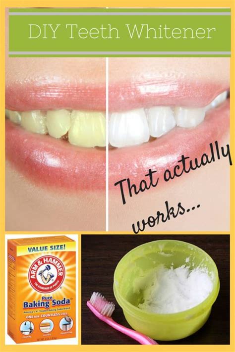 Easy At Home Teeth Whitening For Any Budget The Budget Diet