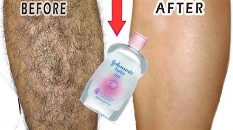 will waxing remove hair permanently servicebv