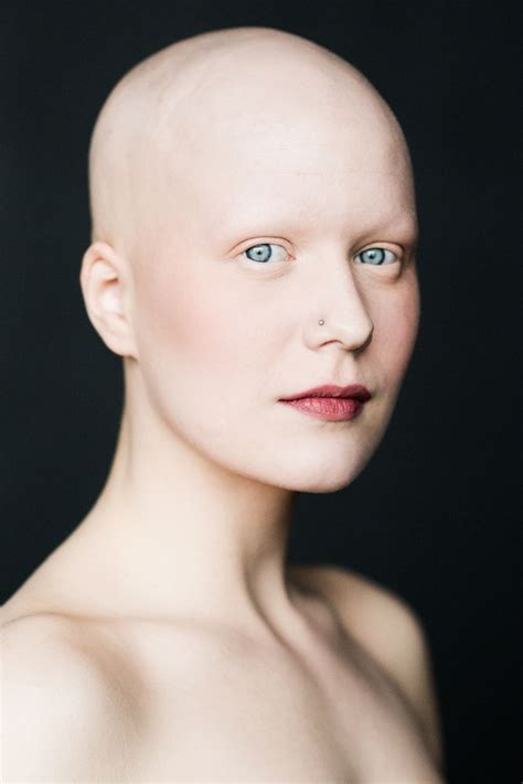 7 Stunning Portraits Of Women With Alopecia Redefine Femininity Bald Women Bald Head Women