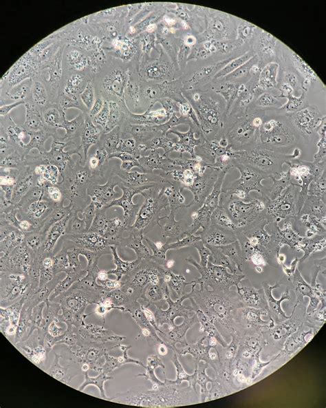 The 'vero' lineage was isolated from kidney epithelial cells extracted from an african green monkey (chlorocebus sp.; 78 questions with answers in VERO CELLS | Scientific method