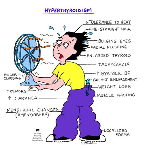 All For Nursing Ms Hypothyroidism Vs Hyperthyroidism