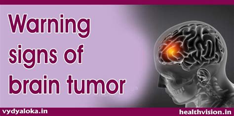 Brain Tumor Warning Signs One Must Not Ignore Health Vision