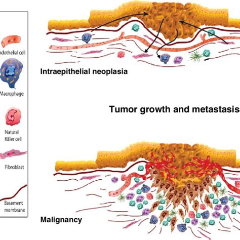 Pdf The Tumor Microenvironment In Colorectal Carcinogenesis