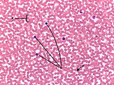 Blood Smear Histology Labeled
