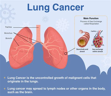 diagram of symptoms lung cancer anatomy system human body anatomy sexiz pix