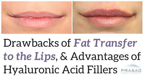 Why Lip Augmentation Is More Predictable And Heals Faster With Cosmetic