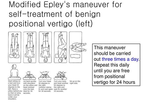 13 Modified Epley Maneuver Pdf Pictures