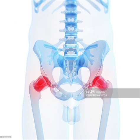 Painful Human Hip Joints Artwork High Res Vector Graphic Getty Images