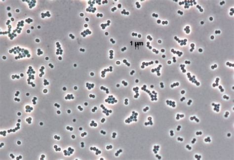 Staphylococcus Warneri E26 Dsm 30881 Bacdiveid14596